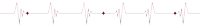 a heartbeat line with red dots on it