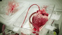 Heart Beating GIF - Heart Beating Surgery GIFs