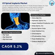 Us Spinal Implants Market GIF