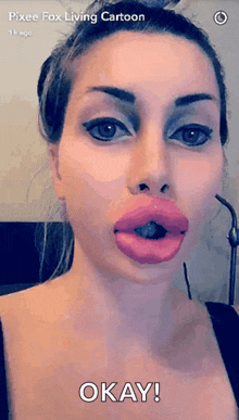 Fake Duck Lips GIF - Fake Duck Lips Botox GIFs