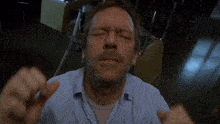 a man wearing a watch holds his head in pain