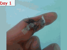 Finger Heal GIF - Finger Heal Wound GIFs