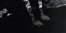 a person with a bandage on their arm is laying on the ground