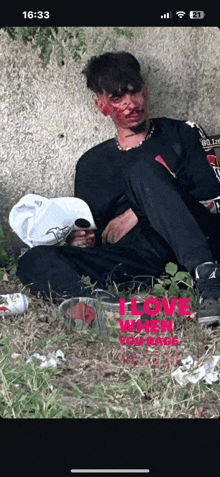 a man with blood on his face is sitting in the grass with the time of 16:33 on his phone
