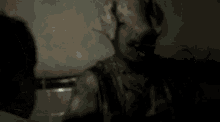 a man in a plaid shirt is bleeding from his chest