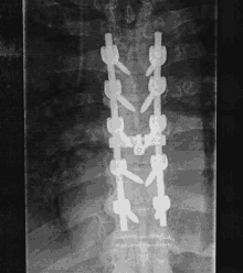 Rücken Titan GIF - Rücken Titan Schrauben GIFs