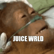 Juice Wrld Dying GIF - Juice Wrld Dying Monkey GIFs