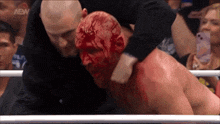 a man in a boxing ring with blood on his face and a aew logo on the bottom right