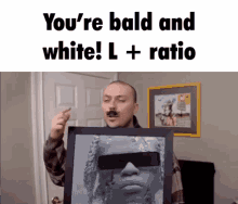 youre you are bald and white l plus ratio take the l