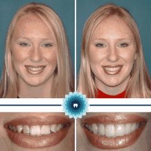 Tmj Specialist Tulsa Dentures And Dental Services Tulsa GIF - Tmj Specialist Tulsa Dentures And Dental Services Tulsa GIFs