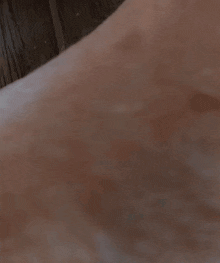 a blurred image of a person 's face with a few spots on it