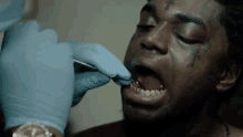 Dental Ouch GIF - Dental Ouch Relaxed GIFs