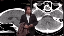 a man in a suit is standing in front of a ct scan of his brain