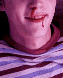 Evan Peters Bleeding GIF - Evan Peters Bleeding Thousandeyes GIFs
