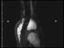 mri scan joint