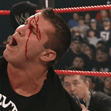 a wrestler with blood on his face is wearing a black shirt that says ' sd ' on the front