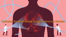 catheter related blood stream infection market