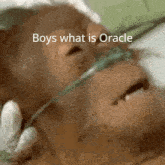 a picture of a monkey with an oxygen mask and the words boys what is oracle