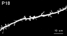 樹状細胞 GIF - Dendrite Neuron Nerve GIFs