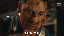 a man with blood on his face and the words it 's me