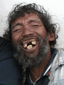 Dentes GIF - Dentes GIFs