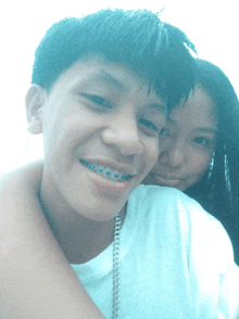 a boy with blue braces on his teeth smiles with a girl behind him