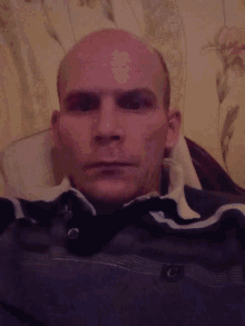 a bald man with a black eye is laying down