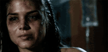 a close up of a woman 's face with bruises on it .