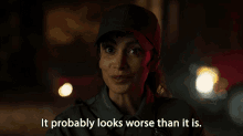 It Probobly Looks Worse Than It Is Ranger Prisha GIF - It Probobly Looks Worse Than It Is Ranger Prisha Wolf Pack GIFs
