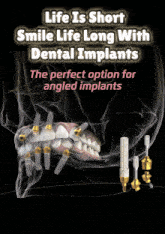 Dental Implants Drjoy GIF - Dental Implants Drjoy Implants GIFs