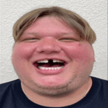 a man with a missing tooth is laughing with his mouth wide open .