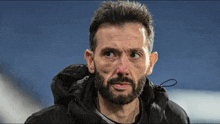 a man with a beard wearing a black jacket with a hood