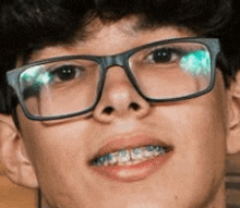 a close up of a young man wearing glasses and braces on his teeth .