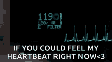 Ekg Machine GIF - Ekg Machine Heart Rate GIFs