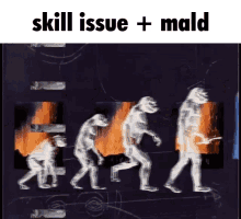 Skill Issue Mald GIF - Skill Issue Mald Cope GIFs
