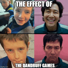 the effect of the dandruff games is shown in a collage of photos
