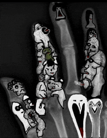 All This Hand Xray GIF