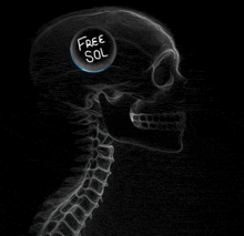 an x-ray of a skull with a free sol sticker