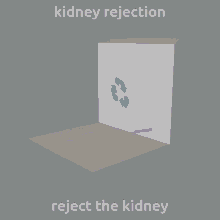 Kidney Rejection Reject The Kidney GIF - Kidney Rejection Reject The Kidney Kidney GIFs