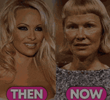 a picture of a woman before and after plastic surgery with the words then and now