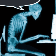 Skeleton Posture Computer GIF - Skeleton Posture Computer GIFs