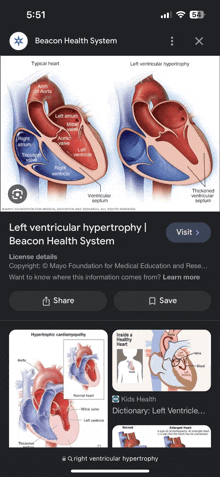 Heart Heart System GIF