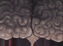 a computer generated image of a brain with a tree growing out of it