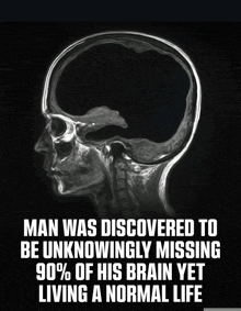 an x-ray of a man 's head with the words man was discovered