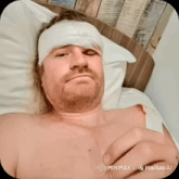 a man with a bandage on his head is laying on a bed