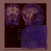 a picture of a brain with the word siemens on it