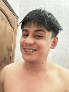 a shirtless young man with braces on his teeth smiles