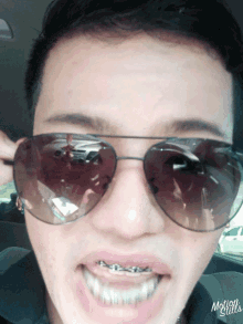 braces glasses selfie