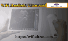 Wifi Handheld Ultrasound Handheld Ultrasound Scanner GIF - Wifi Handheld Ultrasound Handheld Ultrasound Scanner Wifi Mobile Ultrasound GIFs