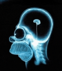 a x-ray of homer simpson 's head with a brain in it .